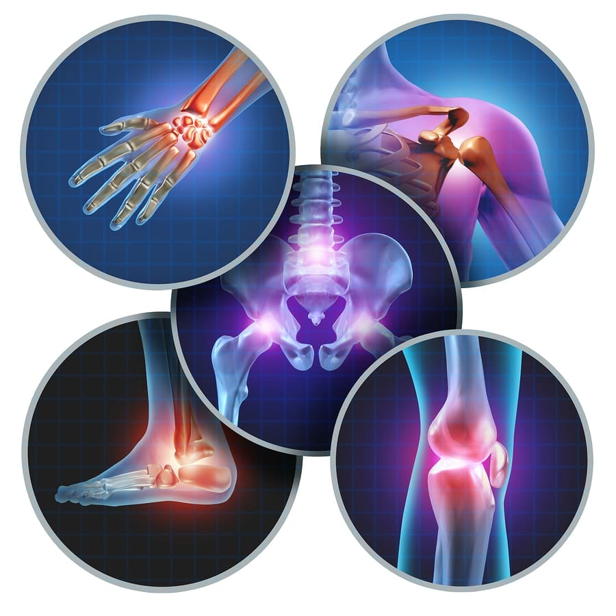 Graphic illustrating inflamed joints in hands, shoulders, feet, knees, and hips