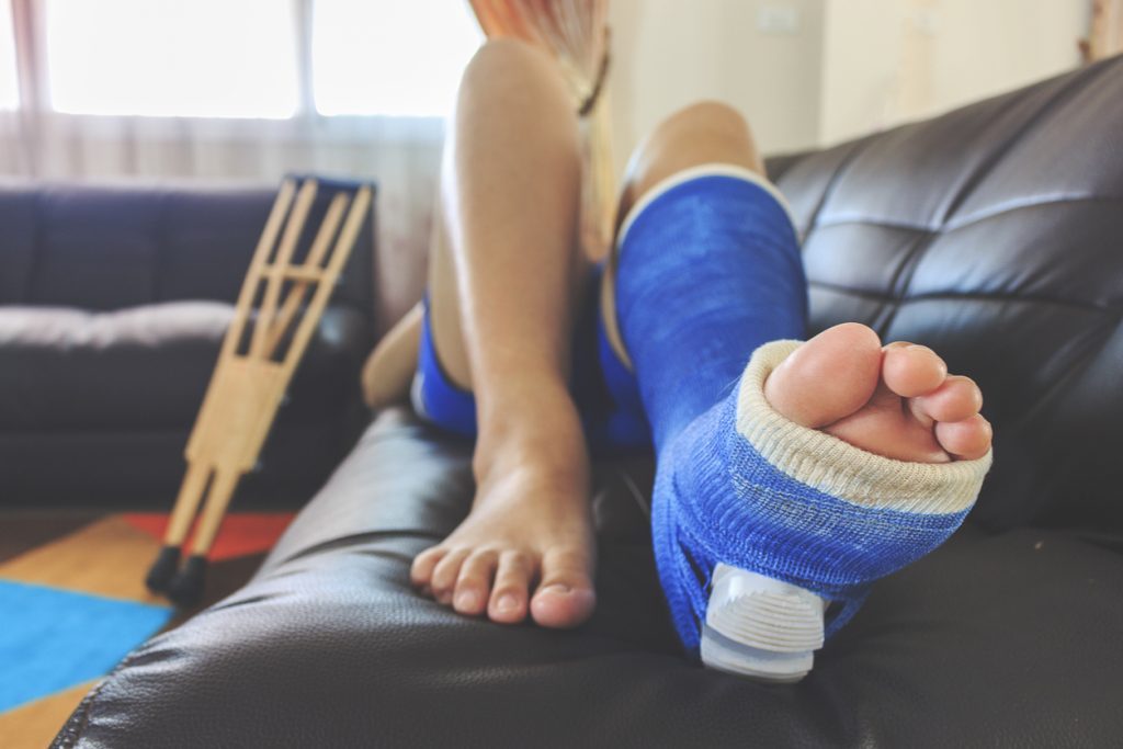 Patient with a fractured ankle lying on a sofa with blue cast and crutches in the background