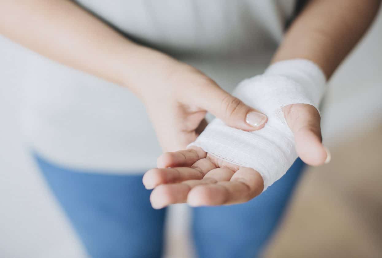 Woman holding hand wrapped in gauze after a flexor tendon tear