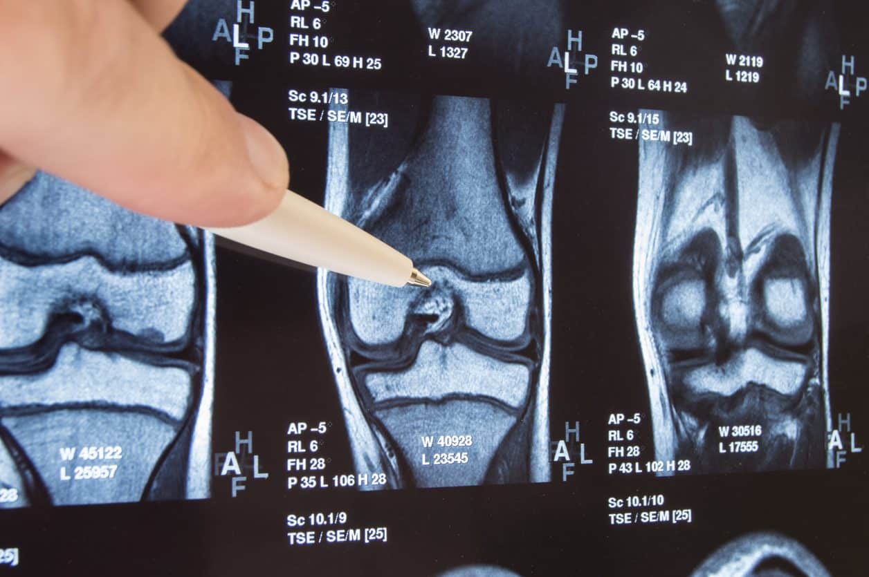 Orthopedic surgeon studying scan of patient’s knee